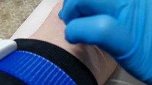 Как берут кровь из вены. Слабонервнм не смотреть!