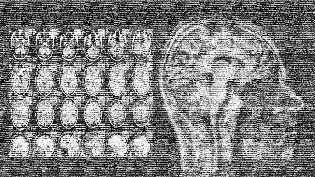Защитный механизм сознания (stopsoznanie.ru)