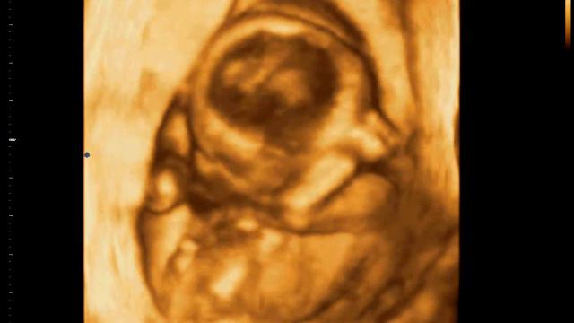 3D узи 1 смотреть онлайн