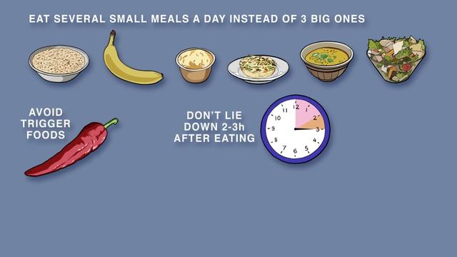 Gastroesophageal Reflux Disease (GERD) смотреть онлайн