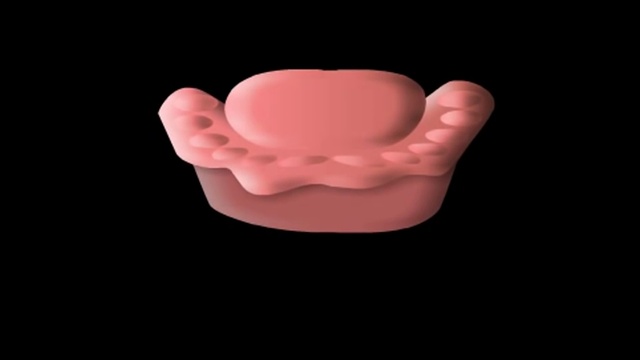 Ошибки при снятии оттиска зуба