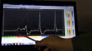 Что будет,если поставить свечу зажигания без резистора (сопротивления) на инжекторе.