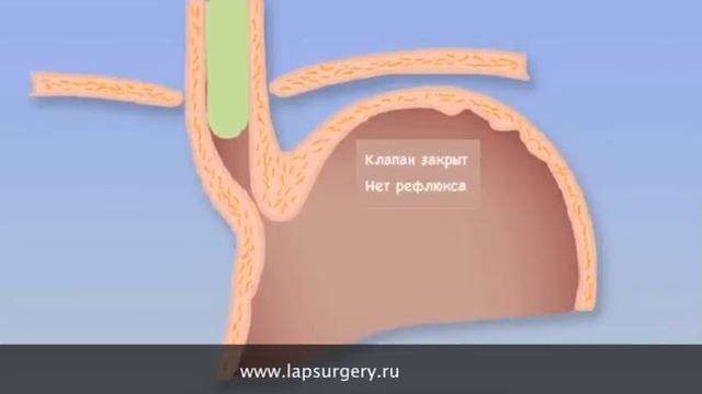 ГПОД смотреть онлайн