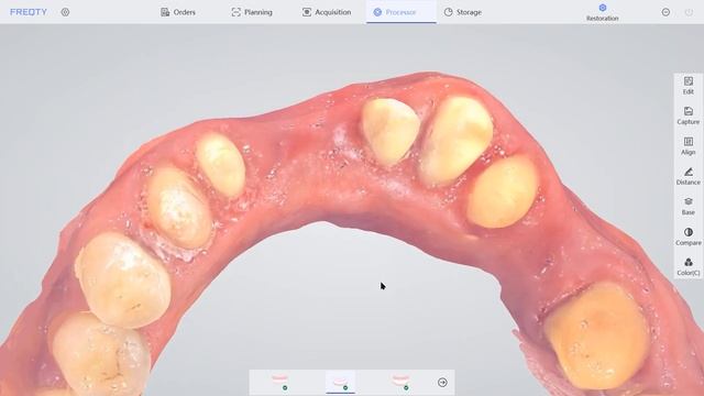 Panda Scanner | Dental Restoration - 1 смотреть онлайн