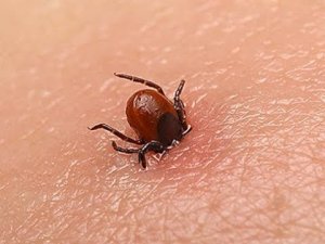 Как вытащить Клеща.Лучший Народный Метод