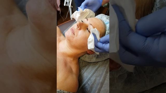 Пилинг PeelArm FORCE PRC Classic смотреть онлайн