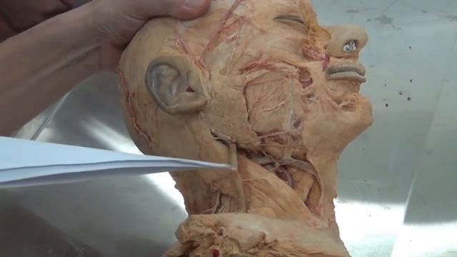 Артерии и вены головы и шеи. смотреть онлайн