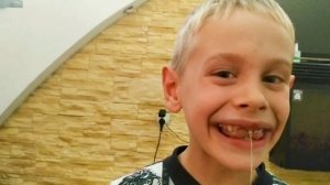 Удаление молочного зуба при помощи нити