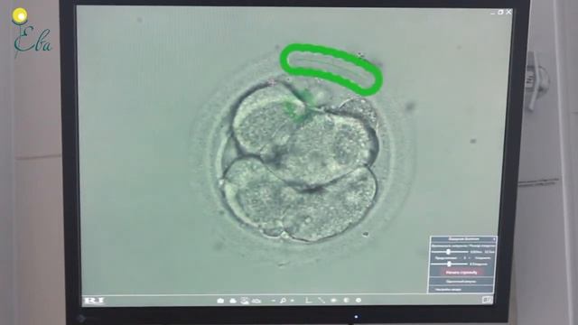 Что такое лазерный хетчинг