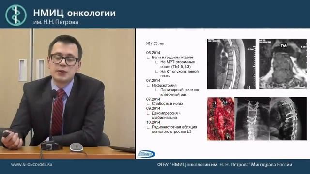 Метастазы в позвоночнике смотреть онлайн