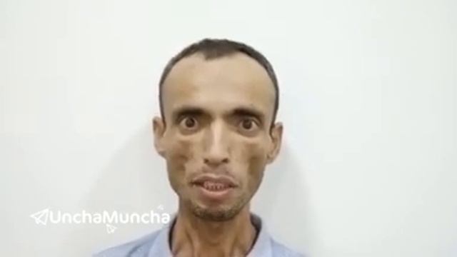 40 кун очлик эълон қилган ўзбек йигити смотреть онлайн