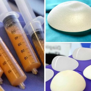 Липофилинг или имплантаты?