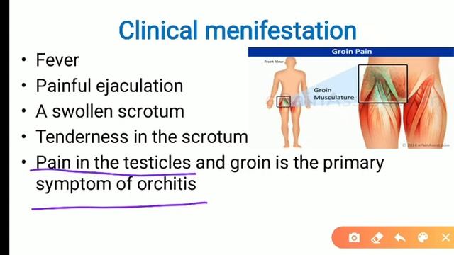 Male Genitouninary System Disorder : Orchitis / Epididymo-orchitis смотреть онлайн