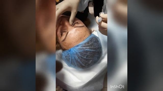 Косметология.Препарат с  молочной кислотой.Reborn.Обучерие