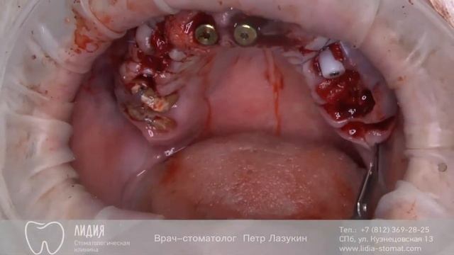 Критические углы смотреть онлайн