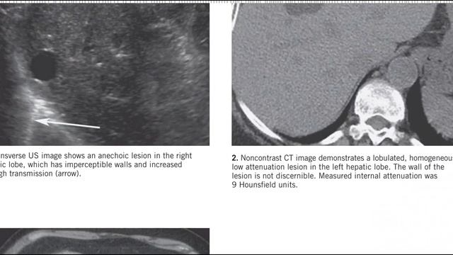 GIT MC GRAW HILL RADIOLOGY BOOKS FRCR(1) смотреть онлайн
