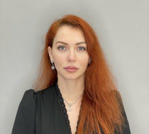 Блефаропластика нижних век.
Результат через 2 недели.