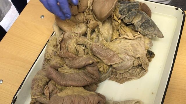 Анатомия. Желудок, Тонкая и Толстая Кишка. смотреть онлайн