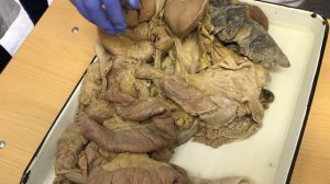 Анатомия. Желудок, Тонкая и Толстая Кишка.