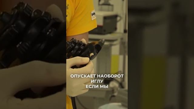 ЭндоУЗИ #эндоскопия #лайфхаки #кисты #пункция #ЭУС смотреть онлайн