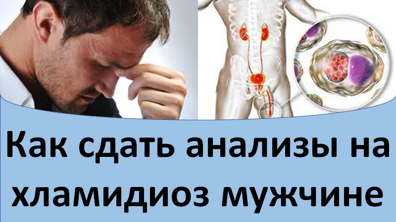 Как сдать анализы на хламидиоз мужчине смотреть онлайн