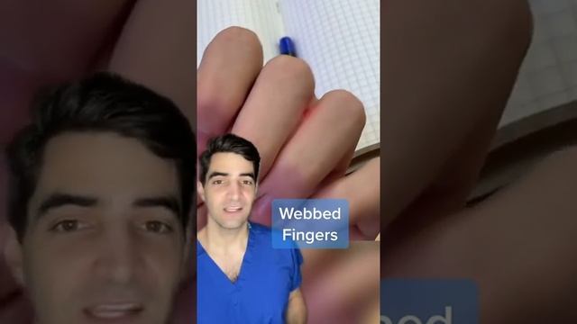 This is a look at webbed fingers, syndactyly смотреть онлайн