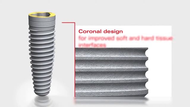 Nobel Biocare Implant Systems смотреть онлайн