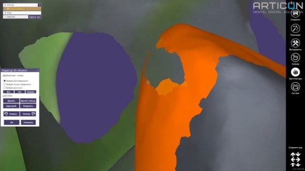 Как исправить ориентацию скана(оттиска) в Exocad