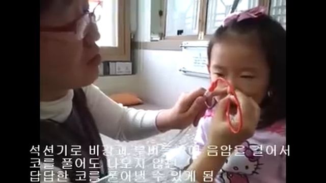 비염 축농증 중이염을 뚝딱 고치는 석션법.wmv смотреть онлайн