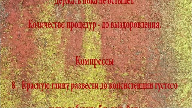 15 народных средств для лечения шпоры