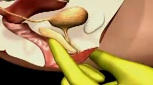 Что такое точка G