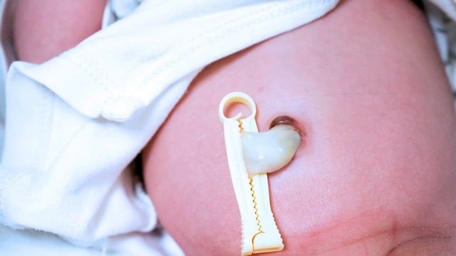 12 интересных фактов о пуповине | ЭТО ВЫ НЕ МОГЛИ ЗНАТЬ О ПУПОВИНЕ НОВОРОЖДЕННОГО смотреть онлайн