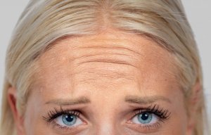 Как избавиться от морщин