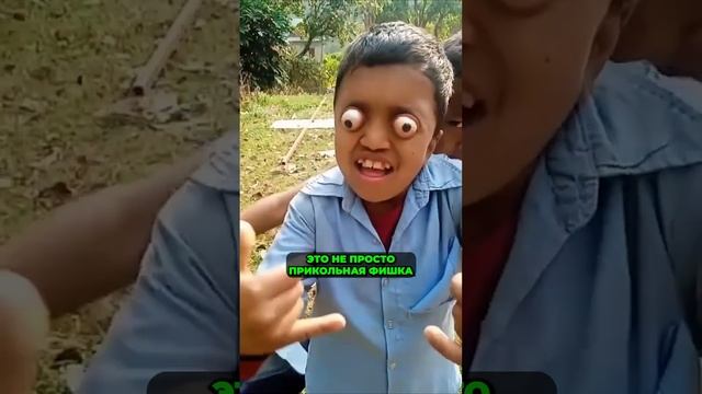 У НЕГО ?️ ВЫПАЛИ ГЛАЗА смотреть онлайн
