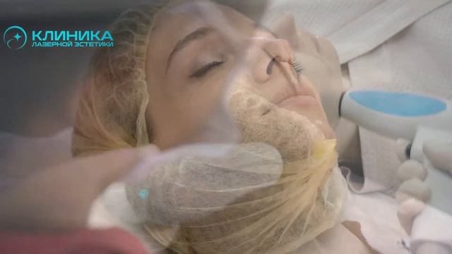 FaceUp омоложение на аппарате Accent XL