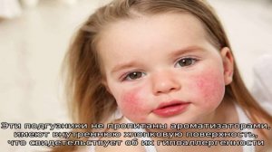 Как выбрать гипоаллергенные подгузники?