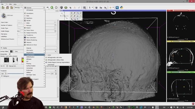 Learn to turn your CAT (CT) or MRI scan into a 3D model. смотреть онлайн