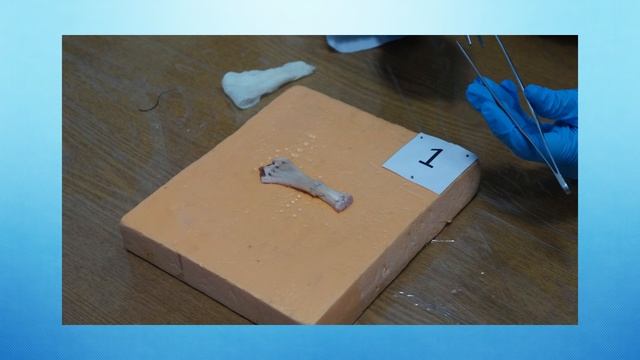 I ВНУТРИВУЗОВСКАЯ ОЛИМПИАДА ПО ХИРУРГИИ ВГМУ смотреть онлайн