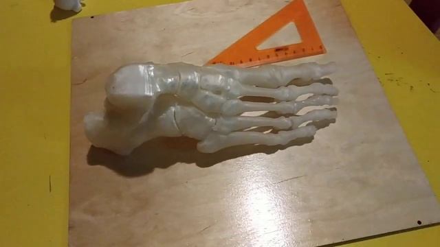 Стопа 25 см 3D печать на основе данных КТ смотреть онлайн