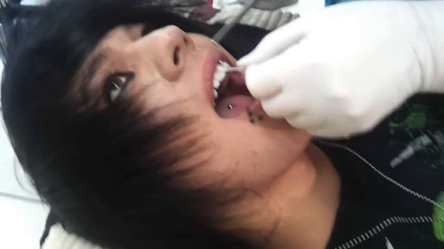 Lippenbändchen Piercing Stechen / Scrumper Piercing / Frenulum