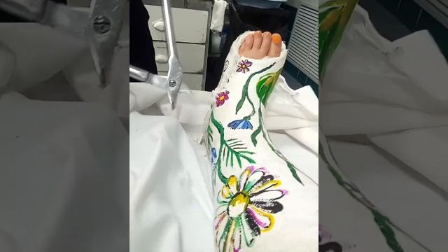 Как снимают гипс смотреть онлайн