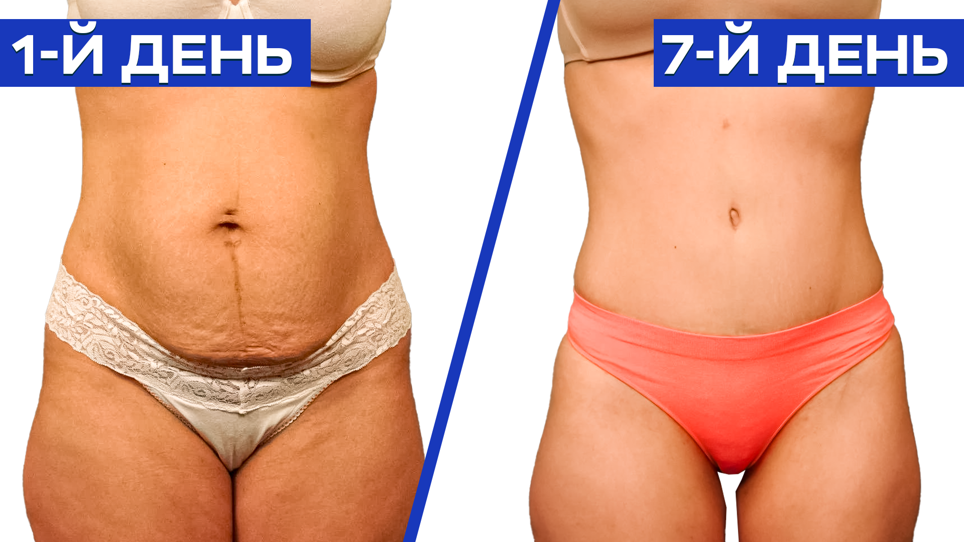 Комплексное восстановление после родов смотреть онлайн