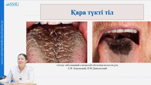 Тіл аурулары смотреть онлайн