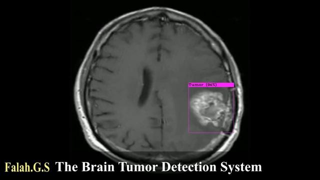 The Brain Tumor Detection System .... смотреть онлайн