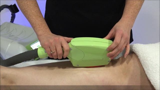 IPL Treatment in action смотреть онлайн