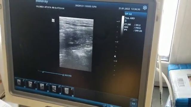 Обследование Лолы