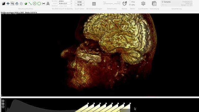 Using Miele-LXIV to look at CT Scans of Brain Rotations смотреть онлайн