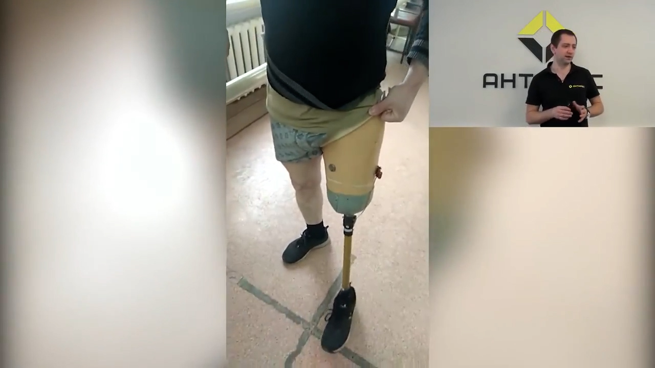 Мой первый протез. Каким он быть (не) должен! смотреть онлайн