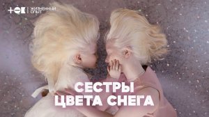 Снежная красота. Как живут сестры-альбиносы в К.