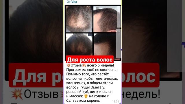 Отзыв. Набор для роста волос. смотреть онлайн